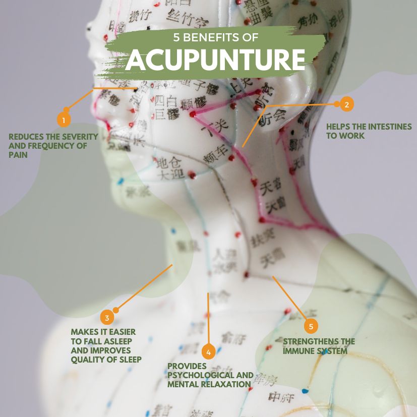 acupunture benefits