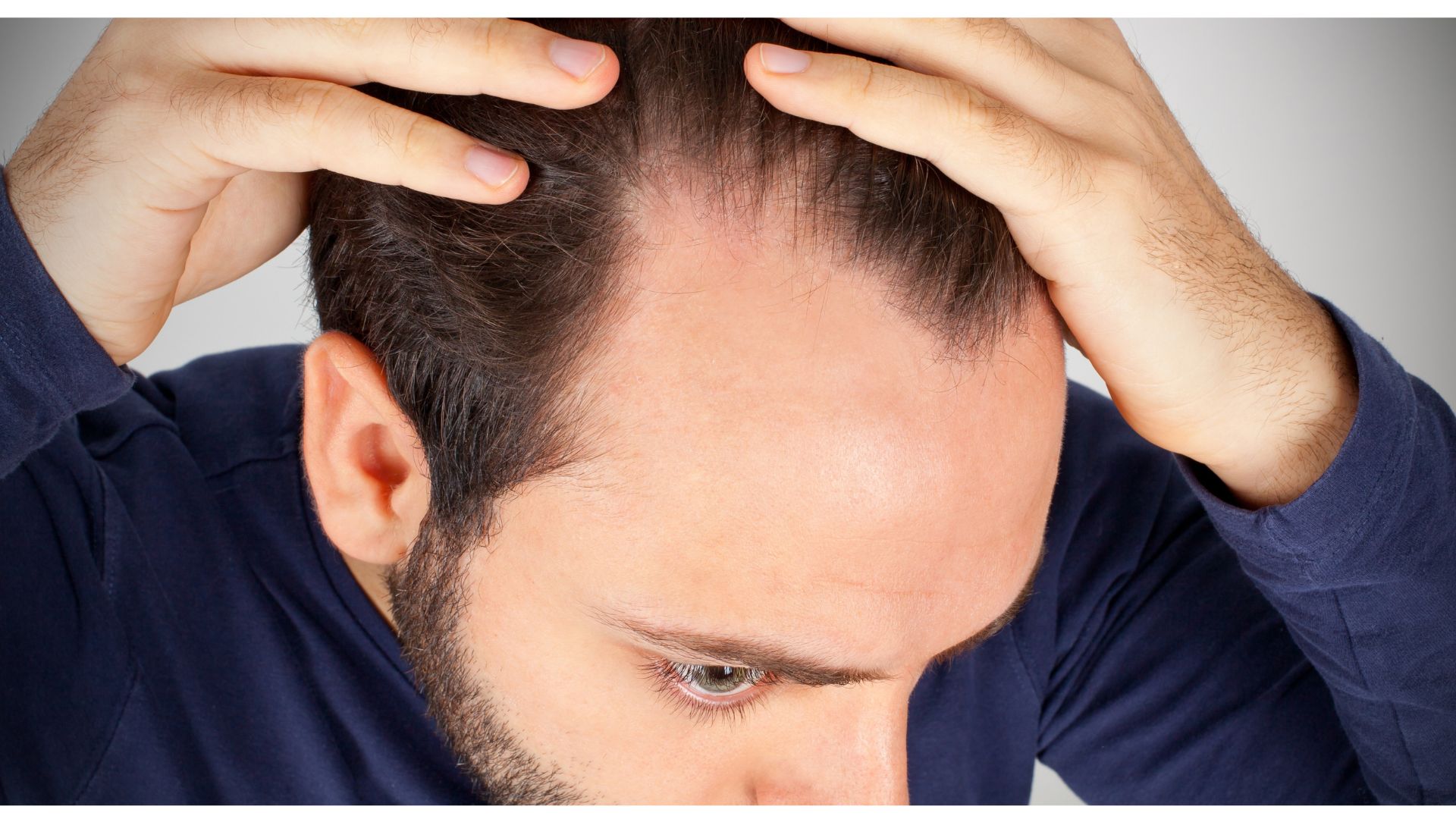 What are the main reasons for hair loss/fall?-Istanbul-centers